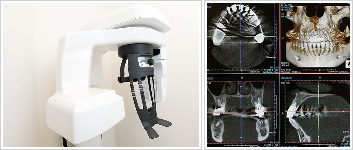 三次元立体画像撮影